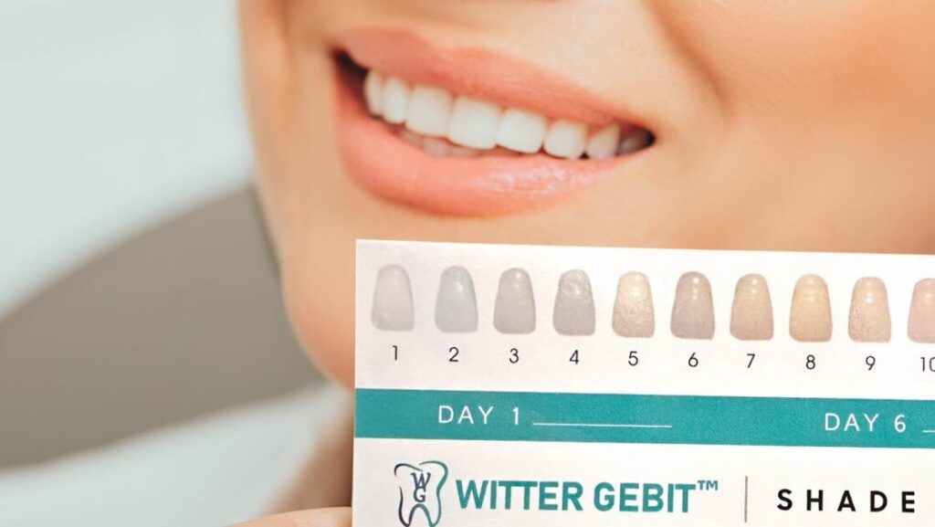 Whitening strips toepassen op tanden voor witere glimlach - duur en instructies