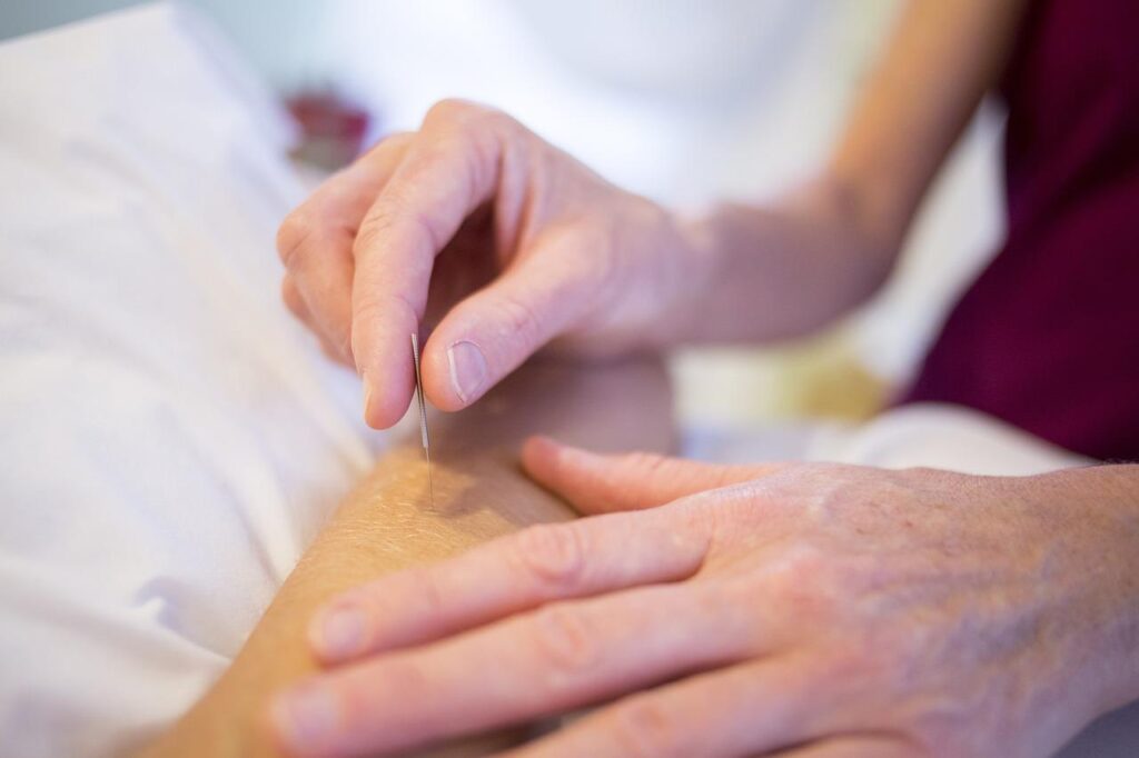 Acupuncturist in Sneek voert behandeling uit met dunne naalden op specifieke lichaampunten